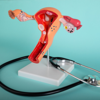 Consulta ginecológica en Andes Salud Ancud para diagnóstico de endometriosis y tratamiento de dolor pélvico.