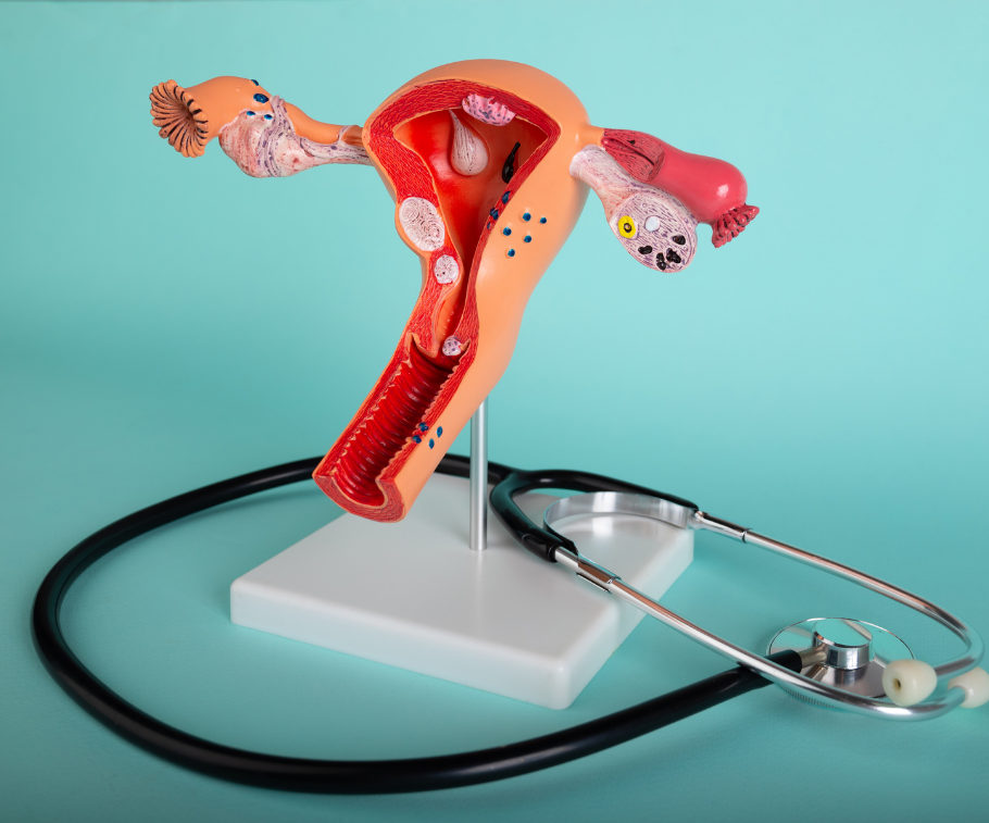 Consulta ginecológica en Andes Salud Ancud para diagnóstico de endometriosis y tratamiento de dolor pélvico.