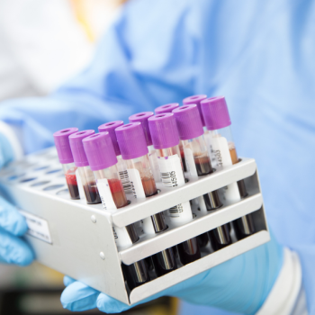 Información sobre exámenes de Laboratorio Clínico en Centro Médico Andes Salud Ancud.
