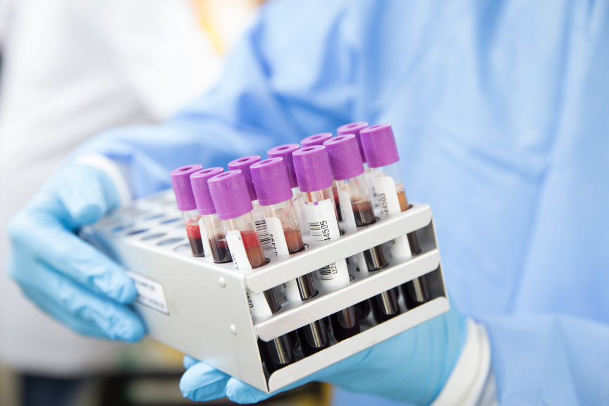 Información sobre exámenes de Laboratorio Clínico en Centro Médico Andes Salud Ancud.