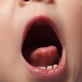 Consulta médica para Evaluación del frenillo lingual en un bebé o niños para mejorar la alimentación y el desarrollo maxilofacial.