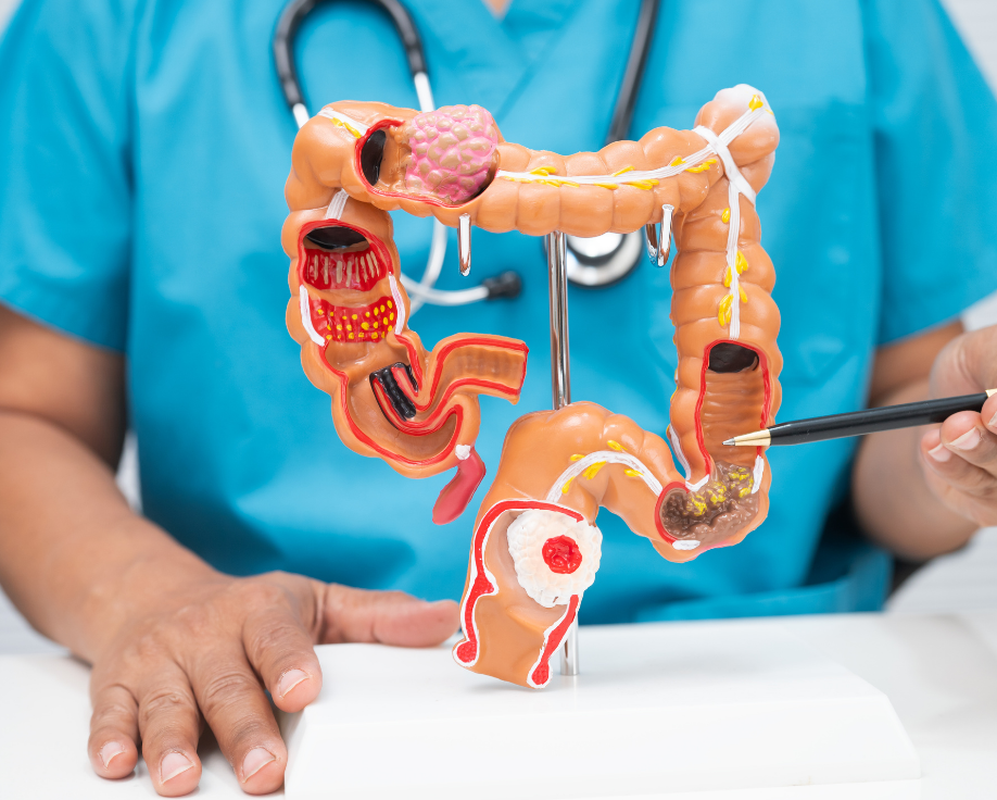 Consulta médica con coloproctólogo para evaluar factores de riesgo y la detección precoz del Cáncer colorrectal.
