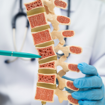 La osteoporosis aumenta con la edad, especialmente en mujeres después de la menopausia, debido a los cambios hormonales que aceleran la pérdida de masa ósea. Agenda tu consulta médica para una diagnostico oportuno
